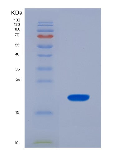 SDS-PAGE analysis of Human FABP6 (Gastrotropin) - Recombinant Protein, showing >90% purity under 15% SDS-PAGE (Reduced)