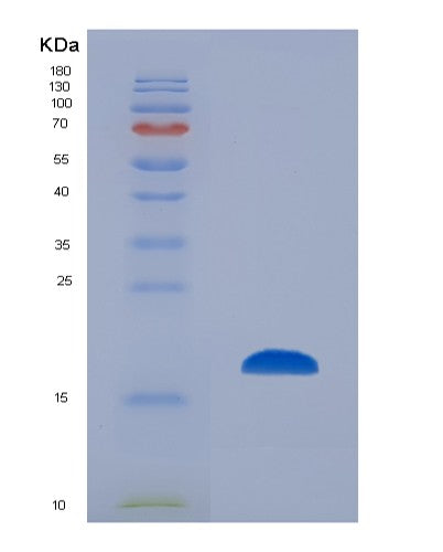 SDS-PAGE analysis of Human FABP9 (Fatty Acid-Binding Protein 9) - Recombinant Protein, showing >90% purity under 15% SDS-PAGE (Reduced)