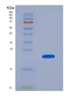 SDS-PAGE analysis of Human CTLA4 (Cytotoxic T-Lymphocyte Protein 4) - Recombinant Protein, showing >90% purity under 15% SDS-PAGE (Reduced)