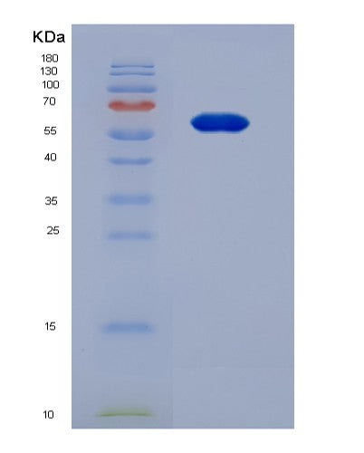 SDS-PAGE analysis of Mouse Prg4 (Proteoglycan 4) - Recombinant Protein, showing >90% purity under 15% SDS-PAGE (Reduced)