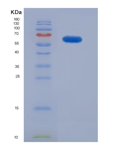 SDS-PAGE analysis of Human EPCAM (Epithelial Cell Adhesion Molecule) - Recombinant Protein, showing >85% purity under 15% SDS-PAGE (Reduced)