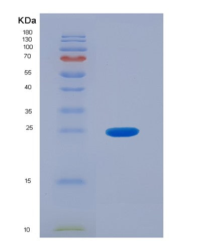 SDS-PAGE analysis of Human MGMT (Methylated-Dna--Protein-Cysteine Methyltransferase) - Recombinant Protein, showing >95% purity under 15% SDS-PAGE (Reduced)
