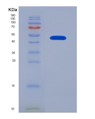 SDS-PAGE analysis of Human RHOQ (Rho-Related Gtp-Binding Protein Rhoq) - Recombinant Protein, showing >95% purity under 15% SDS-PAGE (Reduced)