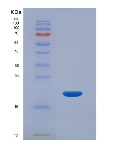 SDS-PAGE analysis of Human HBA1 (Hemoglobin Subunit Alpha) - Recombinant Protein, showing >90% purity under 15% SDS-PAGE (Reduced)