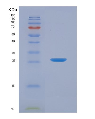 SDS-PAGE analysis of Human MNDA (Myeloid Cell Nuclear Differentiation Antigen) - Recombinant Protein, showing >90% purity under 15% SDS-PAGE (Reduced)