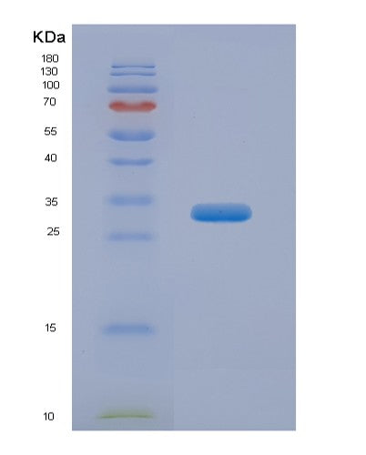 SDS-PAGE analysis of Human ESR1 (Estrogen Receptor) - Recombinant Protein, showing >90% purity under 15% SDS-PAGE (Reduced)