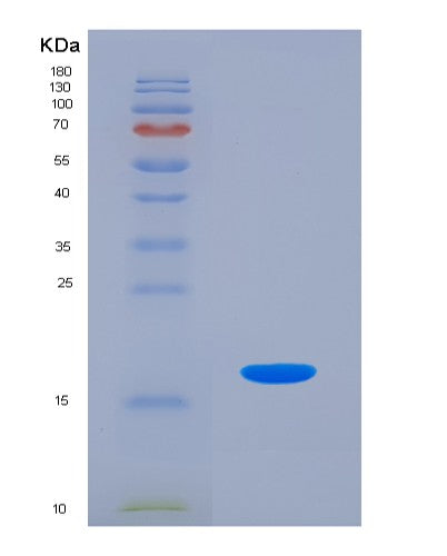 SDS-PAGE analysis of Human HMGA1 (High Mobility Group Protein Hmg-I/Hmg-Y) - Recombinant Protein, showing >85% purity under 15% SDS-PAGE (Reduced)