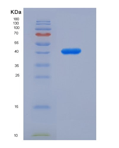 SDS-PAGE analysis of Human GOT1 (Aspartate Aminotransferase, Cytoplasmic) - Recombinant Protein, showing >90% purity under 15% SDS-PAGE (Reduced)