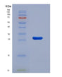 SDS-PAGE analysis of Human DES (Desmin) - Recombinant Protein, showing >85% purity under 15% SDS-PAGE (Reduced)