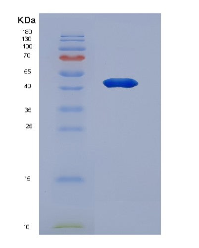 SDS-PAGE analysis of Human GAP43 (Neuromodulin) - Recombinant Protein, showing >85% purity under 15% SDS-PAGE (Reduced)