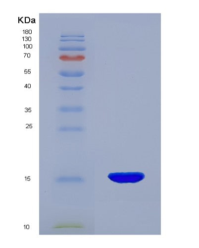 SDS-PAGE analysis of Human ENG (Endoglin) - Recombinant Protein, showing >85% purity under 15% SDS-PAGE (Reduced)