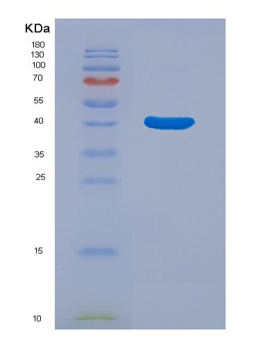 SDS-PAGE analysis of Human PTPN1 (Tyrosine-Protein Phosphatase Non-Receptor Type 1) - Recombinant Protein, showing >95% purity under 15% SDS-PAGE (Reduced)