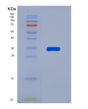 SDS-PAGE analysis of Human NAT1 (Arylamine N-Acetyltransferase 1) - Recombinant Protein, showing >85% purity under 15% SDS-PAGE (Reduced)