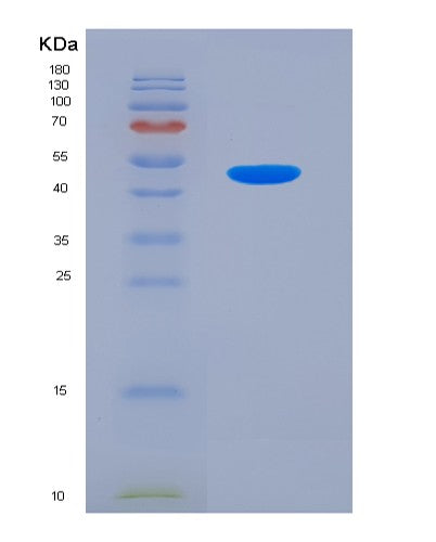 SDS-PAGE analysis of Human VCAM1 (Vascular Cell Adhesion Protein 1) - Recombinant Protein, showing >85% purity under 15% SDS-PAGE (Reduced)