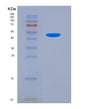 SDS-PAGE analysis of Human VCAM1 (Vascular Cell Adhesion Protein 1) - Recombinant Protein, showing >85% purity under 15% SDS-PAGE (Reduced)