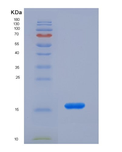 SDS-PAGE analysis of Human HK1 (Hexokinase-1) - Recombinant Protein, showing >90% purity under 15% SDS-PAGE (Reduced)