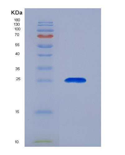 SDS-PAGE analysis of Human ORM2 (Alpha-1-Acid Glycoprotein 2) - Recombinant Protein, showing >85% purity under 15% SDS-PAGE (Reduced)