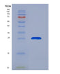 SDS-PAGE analysis of Human ORM2 (Alpha-1-Acid Glycoprotein 2) - Recombinant Protein, showing >85% purity under 15% SDS-PAGE (Reduced)