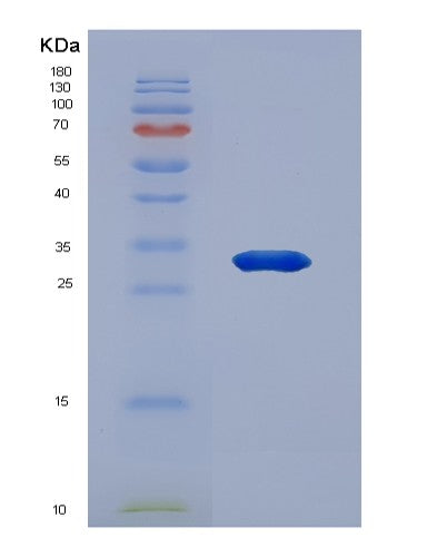 SDS-PAGE analysis of Human FST (Follistatin) - Recombinant Protein, showing >95% purity under 15% SDS-PAGE (Reduced)