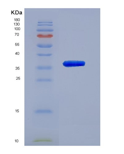 SDS-PAGE analysis of Human CHI3L2 (Chitinase-3-Like Protein 2) - Recombinant Protein, showing >90% purity under 15% SDS-PAGE (Reduced)