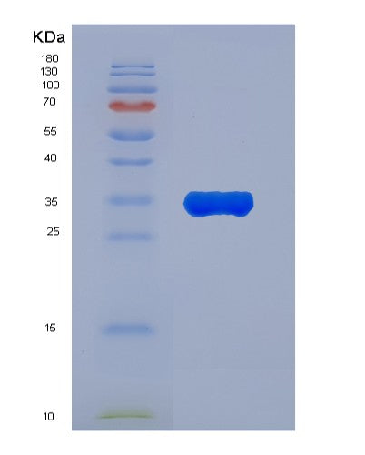 SDS-PAGE analysis of Human ANXA7 (Annexin A7) - Recombinant Protein, showing >85% purity under 15% SDS-PAGE (Reduced)