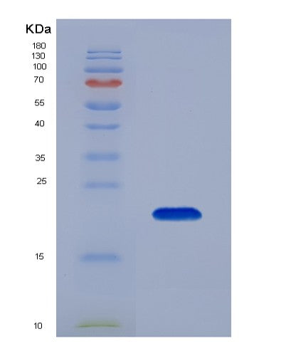 SDS-PAGE analysis of Mouse Lif (Leukemia Inhibitory Factor) - Recombinant Protein, showing >90% purity under 15% SDS-PAGE (Reduced)