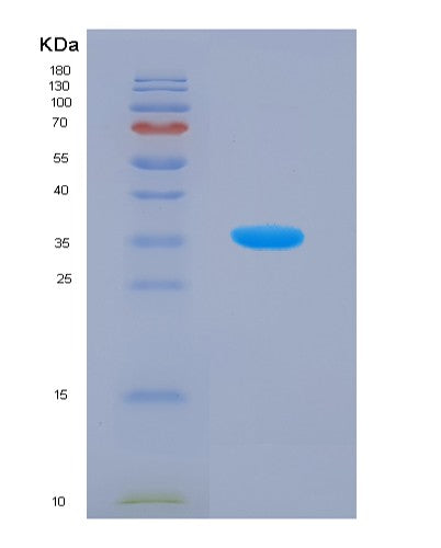 SDS-PAGE analysis of Human SIRT4 (Nad-Dependent Protein Lipoamidase Sirtuin-4, Mitochondrial) - Recombinant Protein, showing >90% purity under 15% SDS-PAGE (Reduced)
