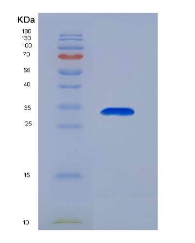 SDS-PAGE analysis of Human GNRHR (Gonadotropin-Releasing Hormone Receptor) - Recombinant Protein, showing >90% purity under 15% SDS-PAGE (Reduced)