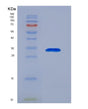 SDS-PAGE analysis of Human GNRHR (Gonadotropin-Releasing Hormone Receptor) - Recombinant Protein, showing >90% purity under 15% SDS-PAGE (Reduced)