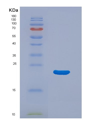 SDS-PAGE analysis of Human M6PR (Cation-Dependent Mannose-6-Phosphate Receptor) - Recombinant Protein, showing >90% purity under 15% SDS-PAGE (Reduced)