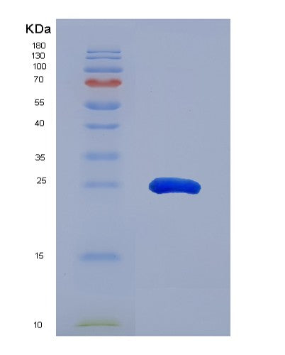 SDS-PAGE analysis of Human DDC (Aromatic-L-Amino-Acid Decarboxylase) - Recombinant Protein, showing >95% purity under 15% SDS-PAGE (Reduced)