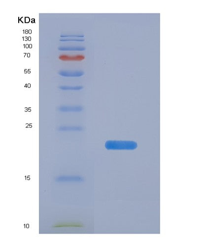 SDS-PAGE analysis of Human EDN2 (Endothelin-2) - Recombinant Protein, showing >90% purity under 15% SDS-PAGE (Reduced)
