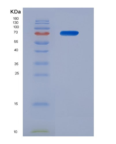 SDS-PAGE analysis of Human MDM2 (E3 Ubiquitin-Protein Ligase Mdm2) - Recombinant Protein, showing >90% purity under 15% SDS-PAGE (Reduced)