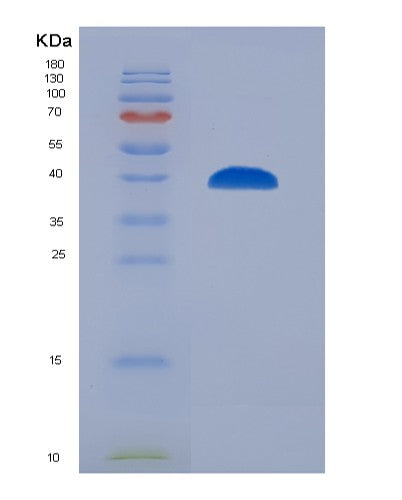 SDS-PAGE analysis of Human SYT1 (Synaptotagmin-1) - Recombinant Protein, showing >90% purity under 15% SDS-PAGE (Reduced)
