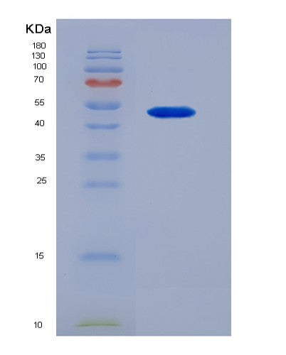 SDS-PAGE analysis of Human NT5E (5'-Nucleotidase) - Recombinant Protein, showing >95% purity under 15% SDS-PAGE (Reduced)