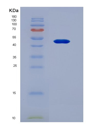 SDS-PAGE analysis of Human MSR1 (Macrophage Scavenger Receptor Types I And Ii) - Recombinant Protein, showing >95% purity under 15% SDS-PAGE (Reduced)