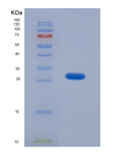 SDS-PAGE analysis of Human KRT18 (Keratin, Type I Cytoskeletal 18) - Recombinant Protein, showing >90% purity under 15% SDS-PAGE (Reduced)