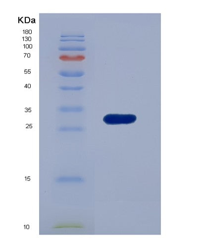 SDS-PAGE analysis of Human TK1 (Thymidine Kinase, Cytosolic) - Recombinant Protein, showing >90% purity under 15% SDS-PAGE (Reduced)