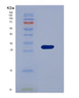 SDS-PAGE analysis of Human TK1 (Thymidine Kinase, Cytosolic) - Recombinant Protein, showing >90% purity under 15% SDS-PAGE (Reduced)