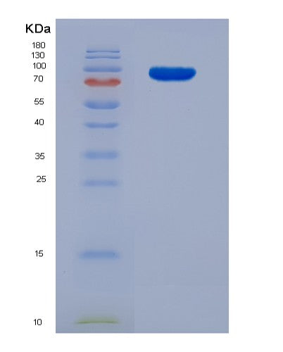 SDS-PAGE analysis of Human TGM2 (Protein-Glutamine Gamma-Glutamyltransferase 2) - Recombinant Protein, showing >85% purity under 15% SDS-PAGE (Reduced)