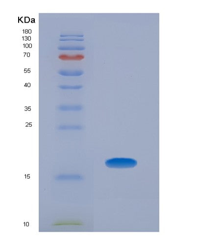 SDS-PAGE analysis of Human BMP5 (Bone Morphogenetic Protein 5) - Recombinant Protein, showing >85% purity under 15% SDS-PAGE (Reduced)