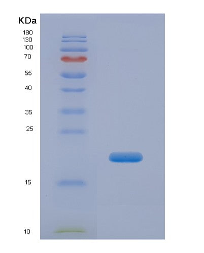 SDS-PAGE analysis of Human CPN2 (Carboxypeptidase N Subunit 2) - Recombinant Protein, showing >85% purity under 15% SDS-PAGE (Reduced)