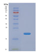 SDS-PAGE analysis of Human CPN2 (Carboxypeptidase N Subunit 2) - Recombinant Protein, showing >85% purity under 15% SDS-PAGE (Reduced)