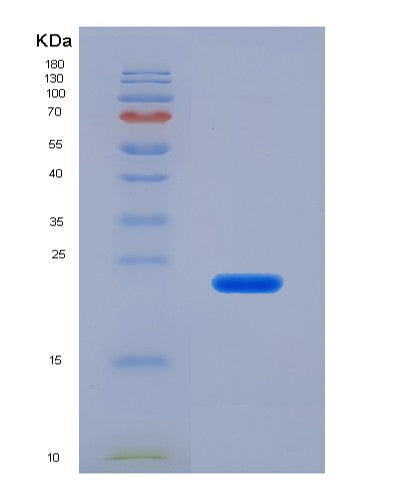 SDS-PAGE analysis of Human CFL1 (Cofilin-1) - Recombinant Protein, showing >90% purity under 15% SDS-PAGE (Reduced)