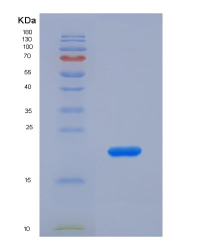 SDS-PAGE analysis of Human DTYMK (Thymidylate Kinase) - Recombinant Protein, showing >90% purity under 15% SDS-PAGE (Reduced)