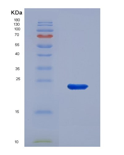 SDS-PAGE analysis of Human GADD45A (Growth Arrest And Dna Damage-Inducible Protein Gadd45 Alpha) - Recombinant Protein, showing >85% purity under 15% SDS-PAGE (Reduced)
