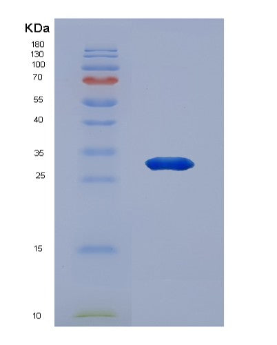 SDS-PAGE analysis of Human EEF1B2 (Elongation Factor 1-Beta) - Recombinant Protein, showing >85% purity under 15% SDS-PAGE (Reduced)