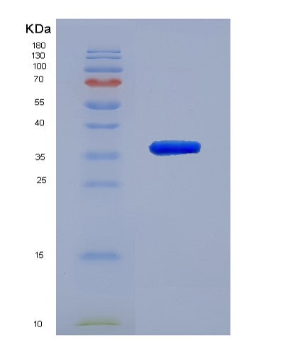 SDS-PAGE analysis of Human ACAT1 (Acetyl-Coa Acetyltransferase, Mitochondrial) - Recombinant Protein, showing >85% purity under 15% SDS-PAGE (Reduced)