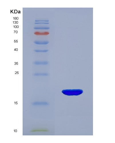 SDS-PAGE analysis of Human MYL9 (Myosin Regulatory Light Polypeptide 9) - Recombinant Protein, showing >95% purity under 15% SDS-PAGE (Reduced)