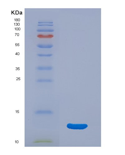 SDS-PAGE analysis of Human CDK2 (Cyclin-Dependent Kinase 2) - Recombinant Protein, showing >95% purity under 15% SDS-PAGE (Reduced)